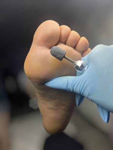 Pedikűrös csiszolósapka 7mm 10db - #120