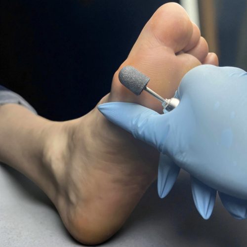 Pedikűrös csiszolósapka 7mm 10db - #120