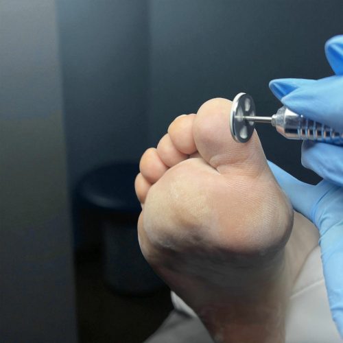 Pedikűrös Csiszolókorong tartó - 15mm