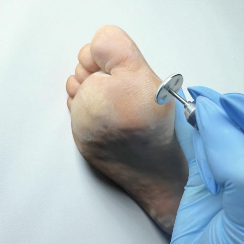 Pedikűrös Csiszolókorong 20mm 50db - #180